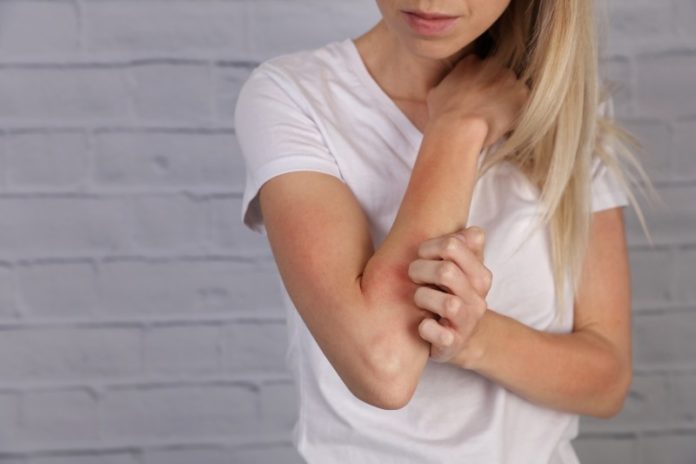 itchy dry skin itchy dry skin